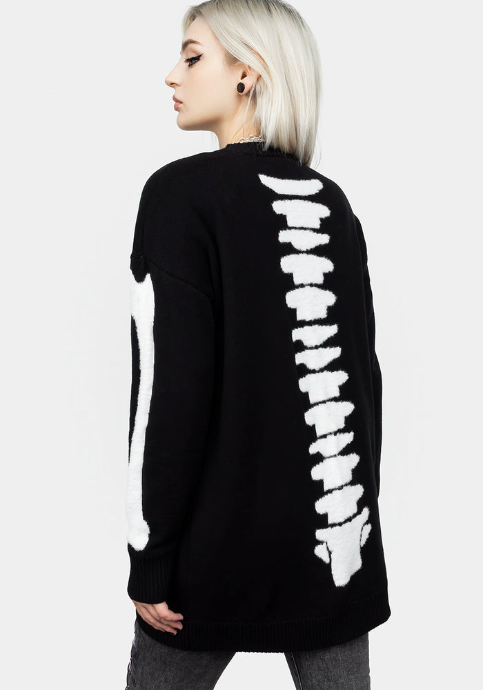 Skeletus Oversized Cardigan